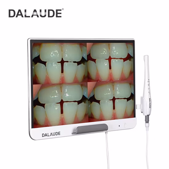 Dental Equipment Digital Oral Endoscopy USB Intra Oral Camera